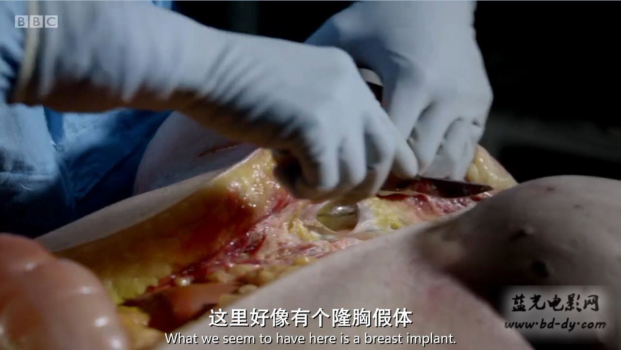 《肥胖症：尸检》2016纪录片.HD720P.中英双字截图